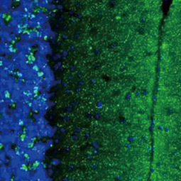 alpha Synuclein antibody [HL1242] (GTX636641)