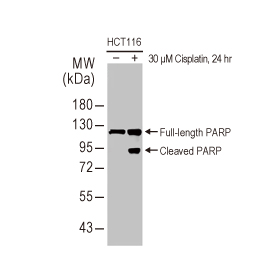 PARP antibody [HL1364] (GTX636804)