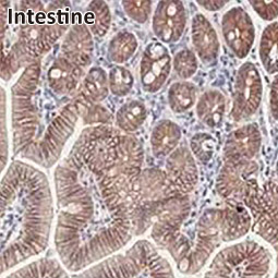 beta Catenin antibody [HL1753] (GTX637403)