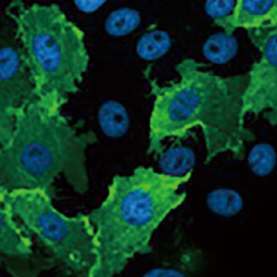 Venezuelan Equine Encephalitis Virus nsP1 antibody [HL1472] (GTX636946)