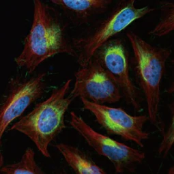 Vimentin antibody [HL1506] (GTX636980)