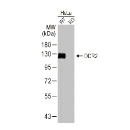 DDR2 antibody [HL1107] (GTX636322)