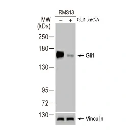 Gli1 antibody [HL247] (GTX635619)