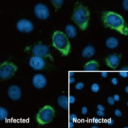 Zika virus Envelope protein antibody [HL1699] (GTX637298)