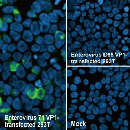 Enterovirus 71 VP1 antibody [HL1929] (GTX637688)