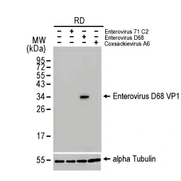 Enterovirus D68 VP1 antibody [HL1997] (GTX637898)