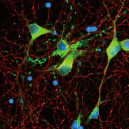 Myelin basic protein antibody [HL1033] (GTX635873)