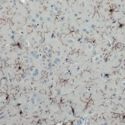 Iba1 antibody [HL22] (GTX635363)