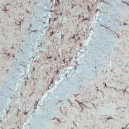 GFAP antibody [HL1307] (GTX636725)