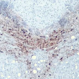 Tyrosine Hydroxylase antibody [HL1762] (GTX637412)