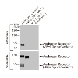 Androgen Receptor (ARv7 Splice Variant) antibody [HL1240] (GTX636639)