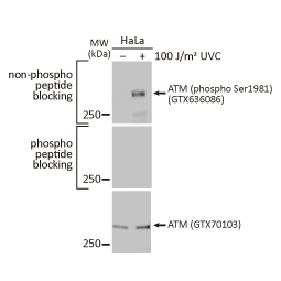 ATM (phospho Ser1981) antibody [HL1062] (GTX636086)