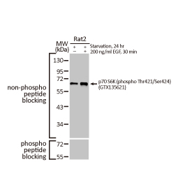 p70 S6K (phospho Thr421/Ser424) antibody [HL129] (GTX635621)