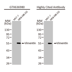 Vimentin antibody [HL1506] (GTX636980)