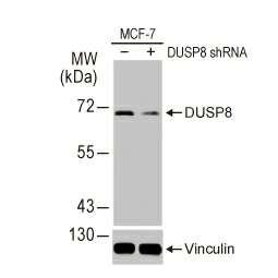 DUSP8 antibody [HL2338] (GTX638541)