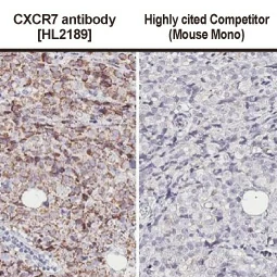 CXCR7 antibody [HL2189] (GTX638193)