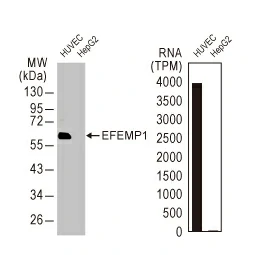 EFEMP1 antibody [HL2572] (GTX638950)
