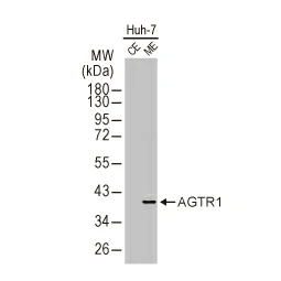 AGTR1 antibody [HL2524] (GTX638885)