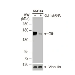 Gli1 antibody [HL247] (GTX635619)