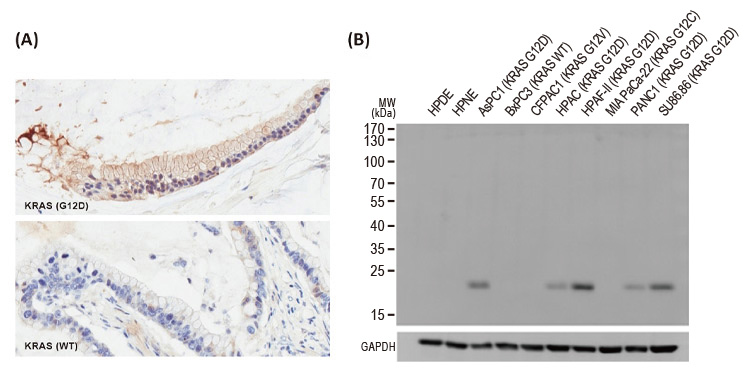 RAS (G12D Mutant) antibody [HL10](GTX635362)