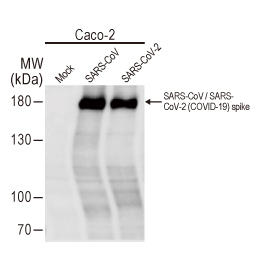SARS-CoV / SARS-CoV-2 (COVID-19) spike antibody [1A9] (GTX632604)