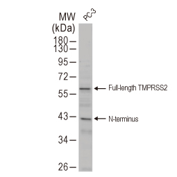 TMPRSS2 antibody [N2C3] (GTX100743)