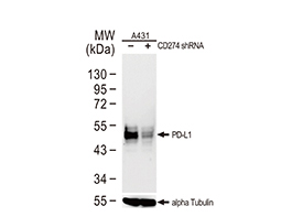 PD-L1 antibody