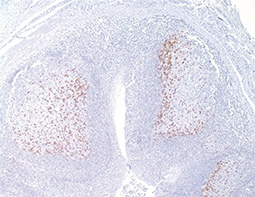 PD-1 antibody