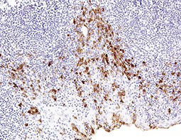 CTLA4 antibody [IHC004]