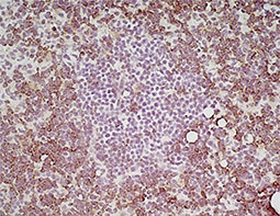 CD4 antibody [GK1.5]