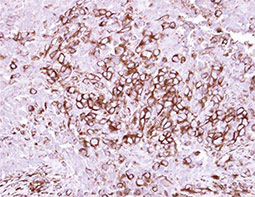 CD40 antibody