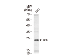 ICOS antibody