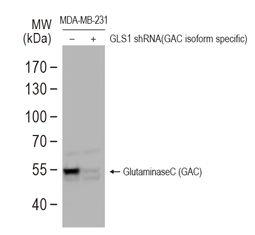 Glutaminase C antibody