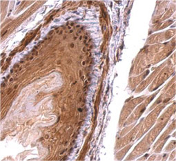 Monoglyceride lipase antibody