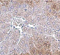 PKM antibody