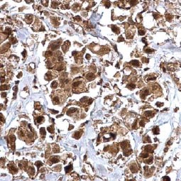 Integrin beta 1 / CD29 antibody (GTX128839)