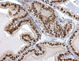 Twist1/2 antibody