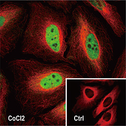 HIF1 alpha antibody