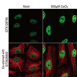 HIF1 beta antibody