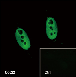 HIF2 alpha antibody