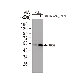 PHD2 antibody