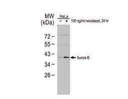 Aurora B antibody