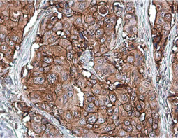 Her2 / ErbB2 antibody [C2C3], C-term