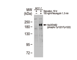Her2 / ErbB2 (phospho Tyr1221/Tyr1222) antibody