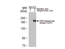 PDGF Receptor beta (phospho Tyr751) antibody