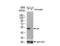 p53 antibody [DO1] 