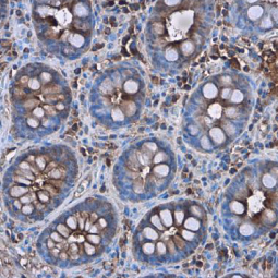 C Reactive Protein antibody [N1C3] (GTX101262)