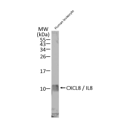 CXCL8 / IL8 antibody (GTX115959)