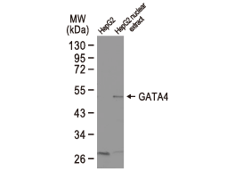 GATA4 antibody (GTX113194)