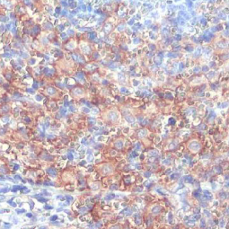 FCER1G antibody [HL1418] (GTX636884)